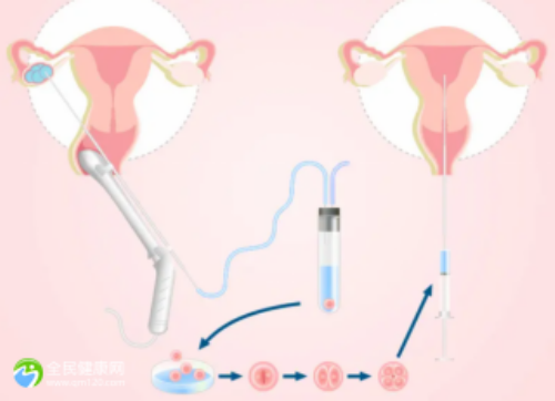 试管被骗如何维权?法律专家教你识破助孕套路并成功追款